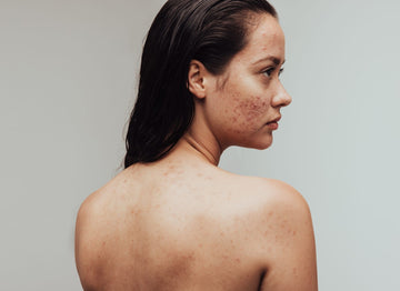 Unveiling Skin Health: Understanding Common Skin Concerns and How to Address Them